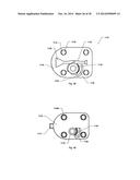 STERNUM FIXATION DEVICE AND METHOD diagram and image