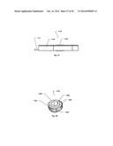 STERNUM FIXATION DEVICE AND METHOD diagram and image