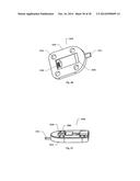 STERNUM FIXATION DEVICE AND METHOD diagram and image