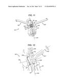 BENDING TOOL AND METHOD FOR RESHAPING A BONE PLATE diagram and image