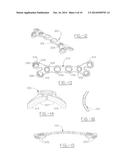 ORTHOPEDIC PLATES FOR USE IN CLAVICLE REPAIR AND METHODS FOR THEIR USE diagram and image