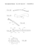 ORTHOPEDIC PLATES FOR USE IN CLAVICLE REPAIR AND METHODS FOR THEIR USE diagram and image