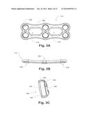 CERVICAL POP RIVET LOCKING MECHANISM diagram and image