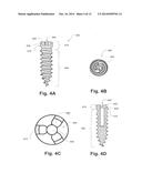 CERVICAL POP RIVET LOCKING MECHANISM diagram and image