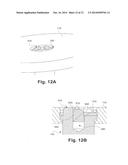 CERVICAL POP RIVET LOCKING MECHANISM diagram and image