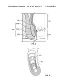System and Method for Electrical Stimulation of Anorectal Structures to     Treat Anal Dysfunction diagram and image