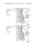 System and Method for Electrical Stimulation of Anorectal Structures to     Treat Anal Dysfunction diagram and image