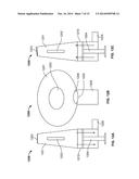 System and Method for Electrical Stimulation of Anorectal Structures to     Treat Anal Dysfunction diagram and image