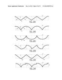 DEVICES AND METHODS FOR VESTIBULAR AND/OR CRANIAL NERVE STIMULATION diagram and image