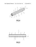 STENT APPARATUS diagram and image