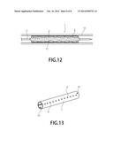 STENT APPARATUS diagram and image