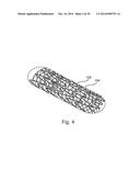 OPTIMIZED DRUG-ELUTING STENT ASSEMBLY diagram and image