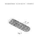 OPTIMIZED DRUG-ELUTING STENT ASSEMBLY diagram and image