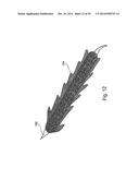 OPTIMIZED DRUG-ELUTING STENT ASSEMBLY diagram and image