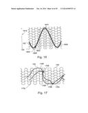 OPTIMIZED DRUG-ELUTING STENT ASSEMBLY diagram and image