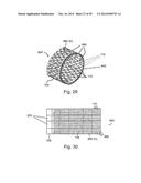 OPTIMIZED DRUG-ELUTING STENT ASSEMBLY diagram and image