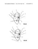 MITRAL HEART VALVE PROSTHESIS AND ASSOCIATED DELIVERY CATHETER diagram and image