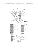 MITRAL HEART VALVE PROSTHESIS AND ASSOCIATED DELIVERY CATHETER diagram and image