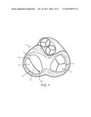 Devices and Methods for Treating Valvular Regurgitation diagram and image