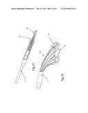 Heart Valve Repair Device diagram and image