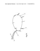 Heart Valve Repair Device diagram and image