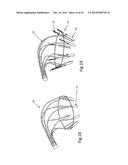 Heart Valve Repair Device diagram and image