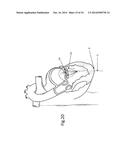 Heart Valve Repair Device diagram and image