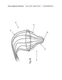 Heart Valve Repair Device diagram and image