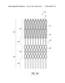 VASCULAR IMPLANT diagram and image