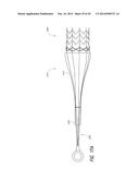 VASCULAR IMPLANT diagram and image