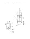 VASCULAR IMPLANT diagram and image