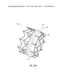 VASCULAR IMPLANT diagram and image