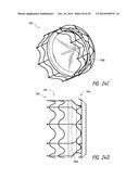 VASCULAR IMPLANT diagram and image