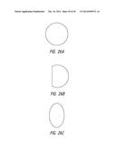 VASCULAR IMPLANT diagram and image