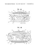 ACCOMMODATIVE INTRAOCULAR LENS diagram and image