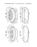 ACCOMMODATIVE INTRAOCULAR LENS diagram and image