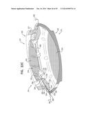 ACCOMMODATIVE INTRAOCULAR LENS diagram and image