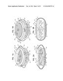 ACCOMMODATIVE INTRAOCULAR LENS diagram and image