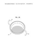 ACCOMMODATIVE INTRAOCULAR LENS diagram and image