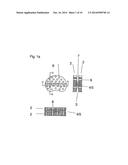 Method of Spinal Treatment diagram and image