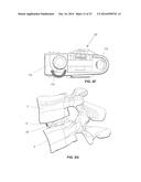 MODULAR, CUSTOMIZABLE SPINE STABILIZATION SYSTEM diagram and image