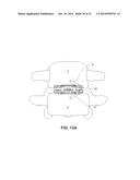 MODULAR, CUSTOMIZABLE SPINE STABILIZATION SYSTEM diagram and image