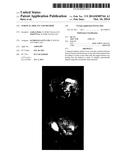 SURGICAL IMPLANT AND METHOD diagram and image