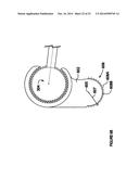 Modular, adjustable, prosthetic, hip/shoulder spacer diagram and image