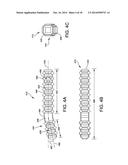 Fusion Implant diagram and image