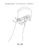 Fusion Implant diagram and image