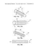 Fusion Implant diagram and image