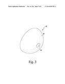 METHOD FOR PERFORMING AN ORTHOPAEDIC PROCEDURE diagram and image