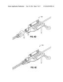 QUICK CONNECT AND DISCONNECT ROPE SYSTEM diagram and image