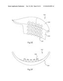 ORTHOPEDIC WALKING BOOT WITH HEEL CUSHION diagram and image